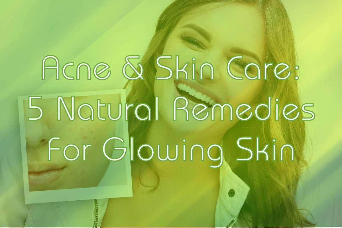 Acne & Skin Care: 5 Natural Remedies For Glowing Skin | Aura Nutrition